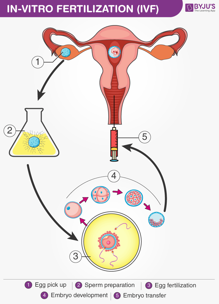 How Old Is IVF Technology?